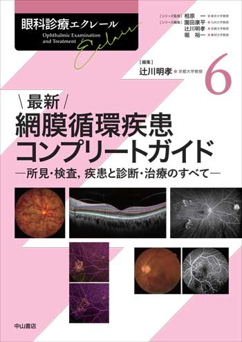 眼科診療エクレール　6　最新 網膜循環疾患コンプリートガイド